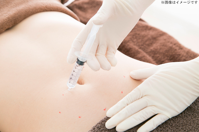 脂肪溶解注射（カベリン）10本の施術チケット｜新宿美容外科クリニック