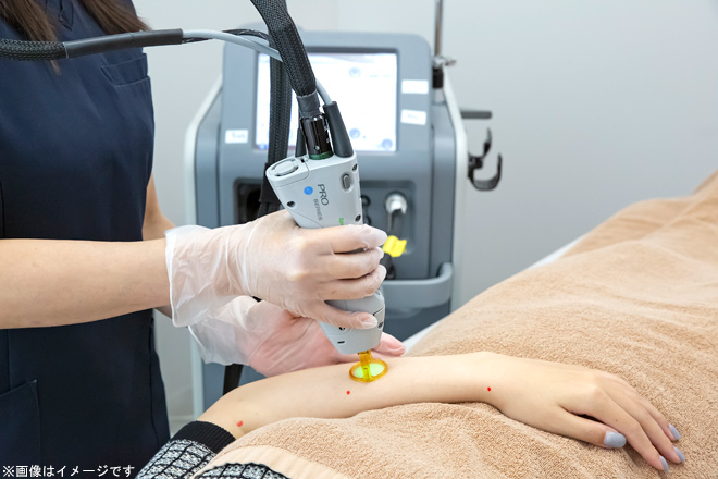 医療レーザー脱毛（ジェントルレーズプロ）全顔の施術チケット｜ミセル