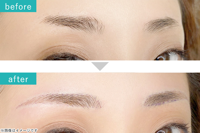 アートメイク（毛並みやパウダーなど3つの技法から選択）両眉［麻酔込