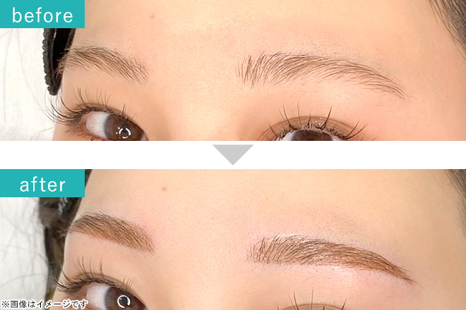 アートメイク　眉毛 仙台宮城東北アートメイク専門クリニック（眉・アイライン・唇