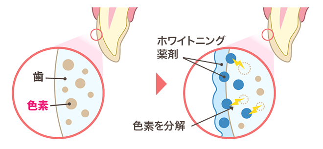 なぜ歯が白くなるの？