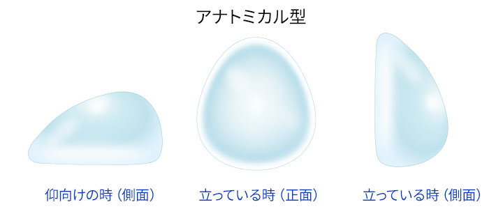 アナトミカル型