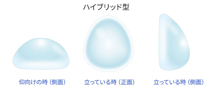 ハイブリッド型