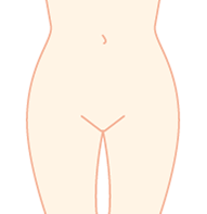 ハイジニーナ(無毛)